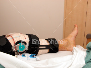 knee surg knee surg